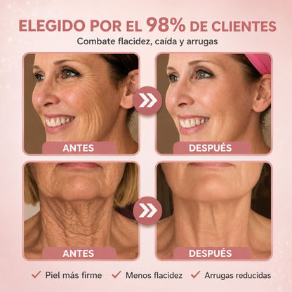 Efecto “Botox” sin agujas. En casa, en minutos.